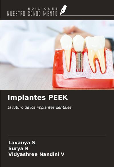 Implantes PEEK