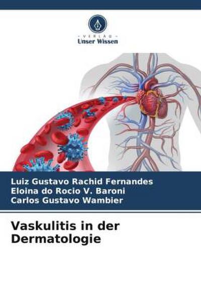 Vaskulitis in der Dermatologie