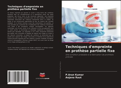 Techniques d’empreinte en prothèse partielle fixe