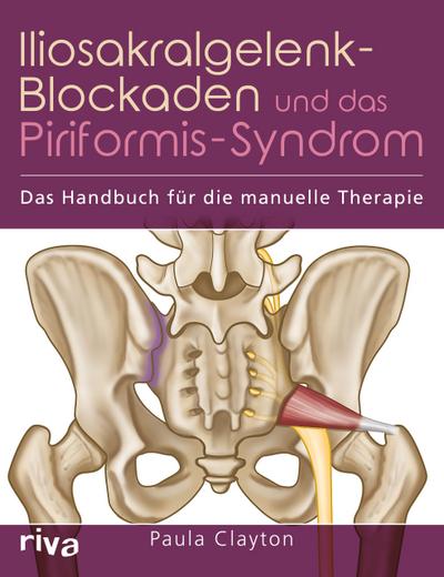 Iliosakralgelenk-Blockaden und das Piriformis-Syndrom