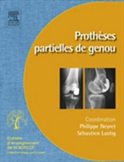 Protheses partielles du genou