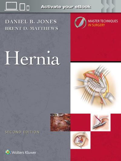 Master Techniques in Surgery: Hernia: Print + eBook with Multimedia