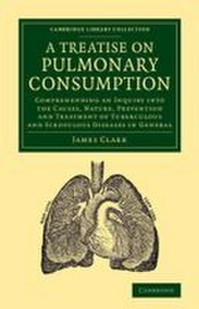 A   Treatise on Pulmonary Consumption