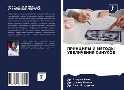 PRINCIPY I METODY UVELIChENIYa SINUSOV