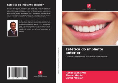 Estética do implante anterior