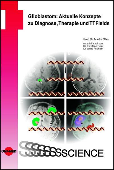 Glioblastom: Aktuelle Konzepte zu Diagnose, Therapie und TTFields