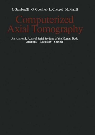 Computerized Axial Tomography