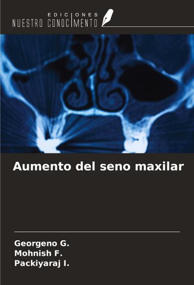 Aumento del seno maxilar