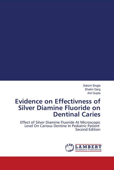 Evidence on Effectivness of Silver Diamine Fluoride on Dentinal Caries