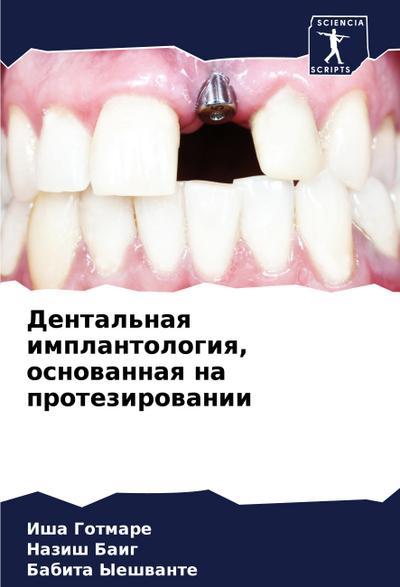 Dental’naq implantologiq, osnowannaq na protezirowanii