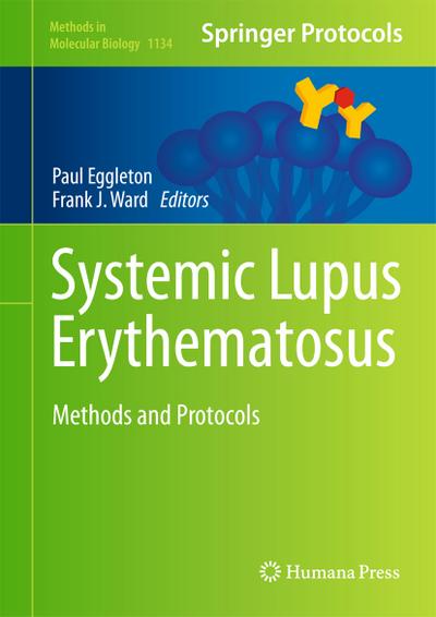 Systemic Lupus Erythematosus