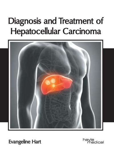 Diagnosis and Treatment of Hepatocellular Carcinoma