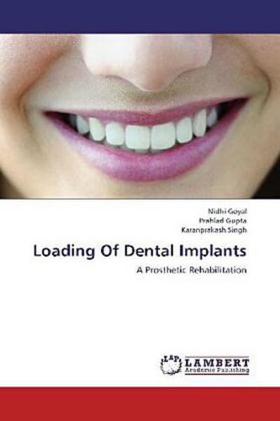 Loading Of Dental Implants
