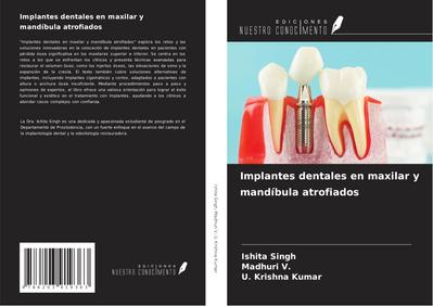 Implantes dentales en maxilar y mandíbula atrofiados