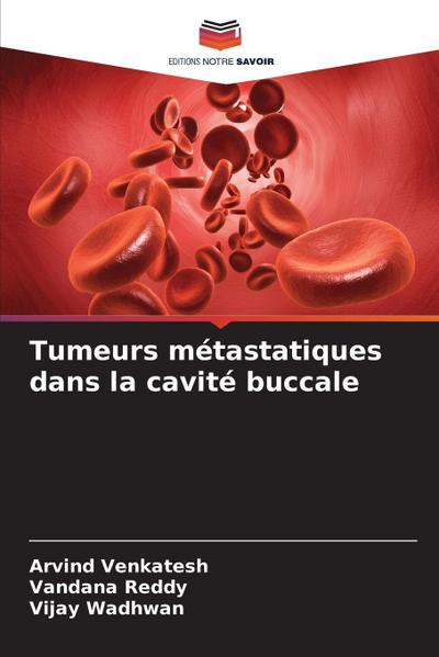 Tumeurs métastatiques dans la cavité buccale