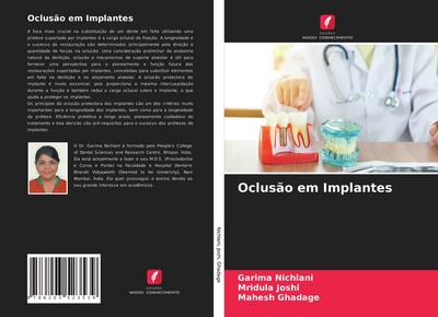 Oclusão em Implantes