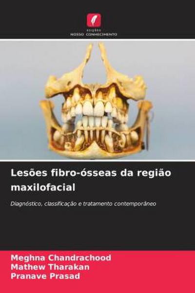 Lesões fibro-ósseas da região maxilofacial