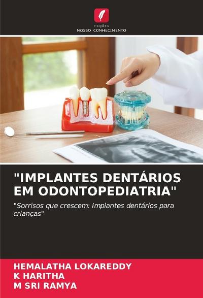 "IMPLANTES DENTÁRIOS EM ODONTOPEDIATRIA"