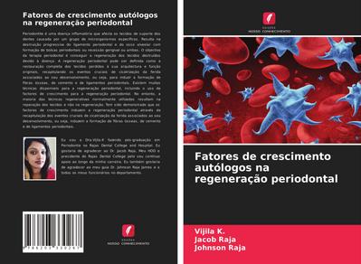 Fatores de crescimento autólogos na regeneração periodontal