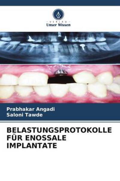 BELASTUNGSPROTOKOLLE FÜR ENOSSALE IMPLANTATE