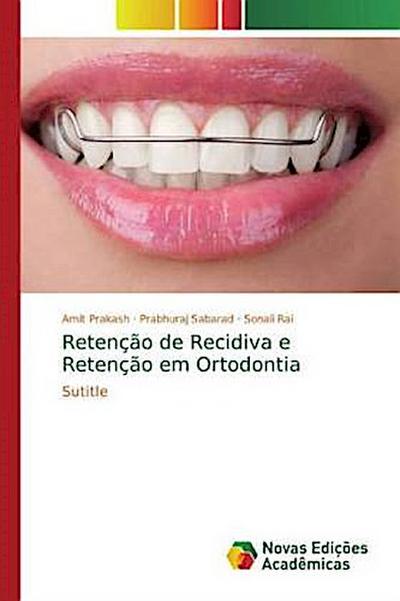 Retenção de Recidiva e Retenção em Ortodontia