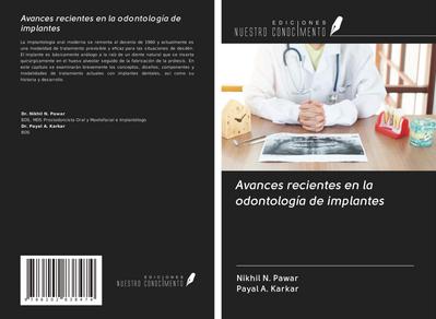 Avances recientes en la odontología de implantes