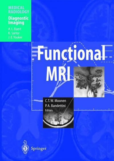 Functional MRI