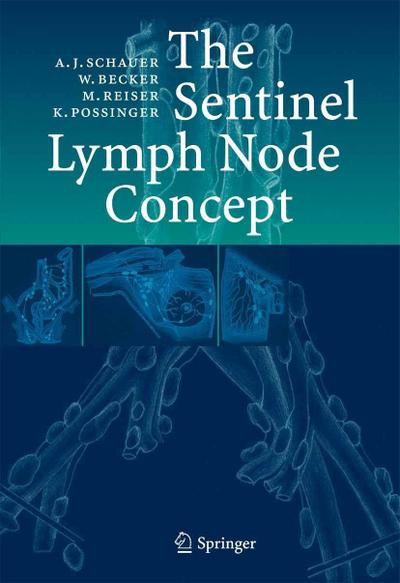 The Sentinel Lymph Node Concept