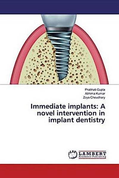 Immediate implants: A novel intervention in implant dentistry