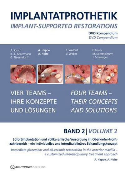 Implantatprothetik. DVD, Band 2