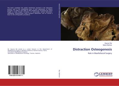 Distraction Osteogenesis