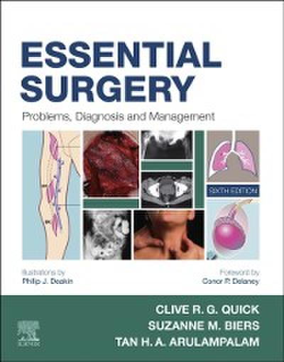 Essential Surgery E-Book