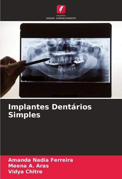 Implantes Dentários Simples