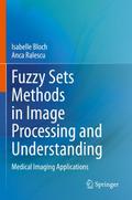 Fuzzy Sets Methods in Image Processing and Underst