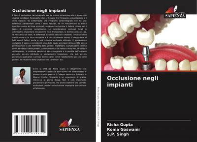 Occlusione negli impianti