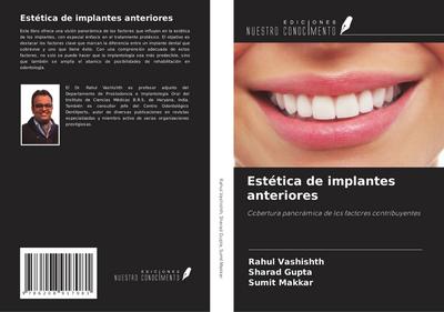 Estética de implantes anteriores