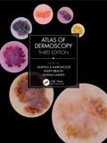 Atlas of Dermoscopy