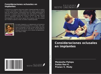 Consideraciones oclusales en implantes