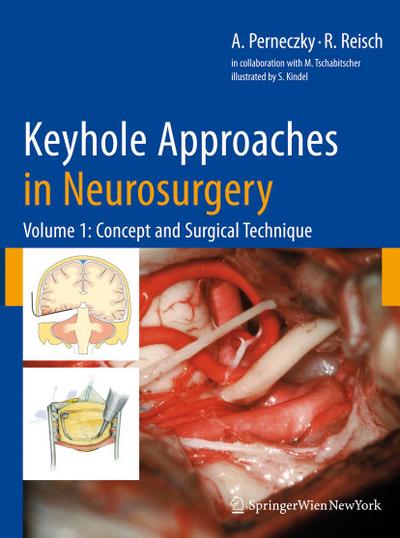 Keyhole Approaches in Neurosurgery