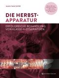 Die Herbst-Apparatur von Hans Pancherz | Ebook