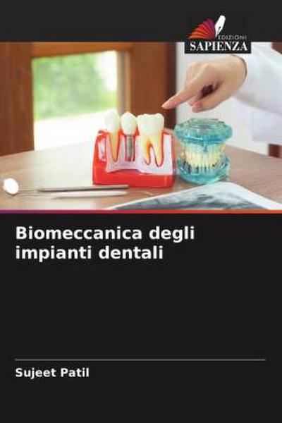 Biomeccanica degli impianti dentali