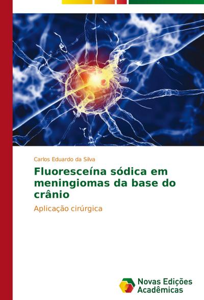 Fluoresceína sódica em meningiomas da base do crânio - Carlos Eduardo da Silva
