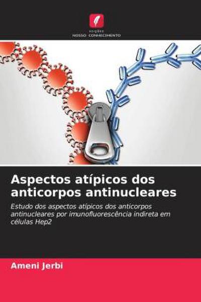 Aspectos atípicos dos anticorpos antinucleares