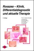 Rosazea - Klinik, Differentialdiagnostik und aktue