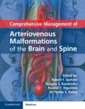 Comprehensive Management of Arteriovenous Malforma
