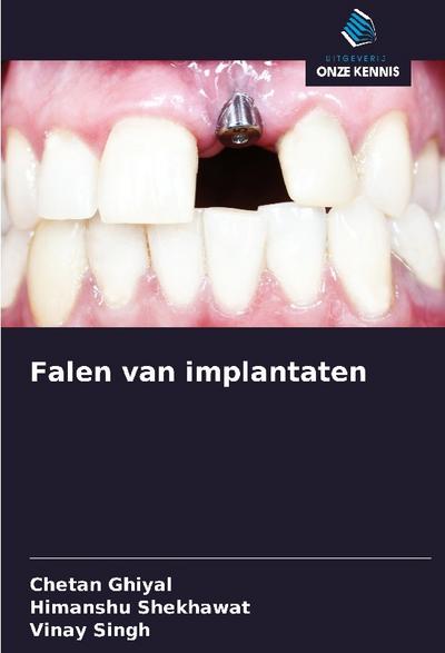 Falen van implantaten