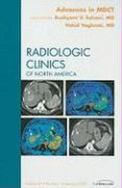 Advances in Mdct, an Issue of Radiologic Clinics