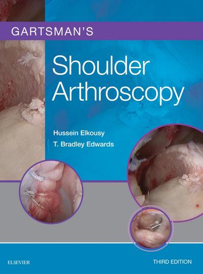 Gartsman’s Shoulder Arthroscopy E-Book