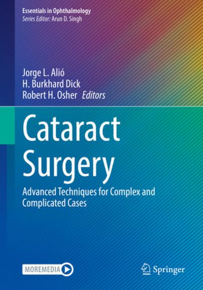 Cataract Surgery