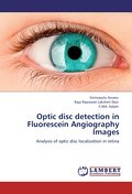 Optic disc detection in Fluorescein Angiography Im